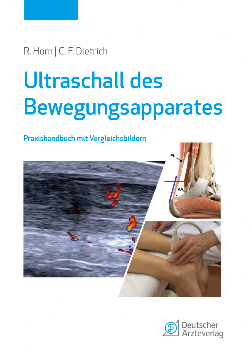 Emergency Ultrasound Bewegungsapparates